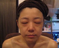 なんと！1回だけの施術です